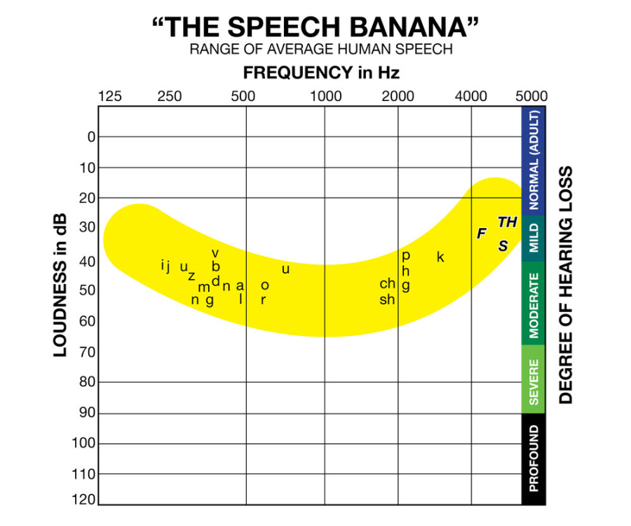 The “Speech Banana” shows where a person’s hearing falls. Most people land on the upper sides of the banana while senior Lauren Batley falls in the curve, unable to hear specific sounds. Batley has a condition called reverse-lobe bilateral hearing loss. “The speech banana is where the English language falls and my hearing isn’t up top where everyone else’s is, it’s down within that speech banana,” Batley said.